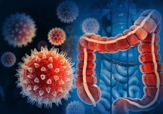 Preventive Care for Colon Cancer with Acupuncture and Herb